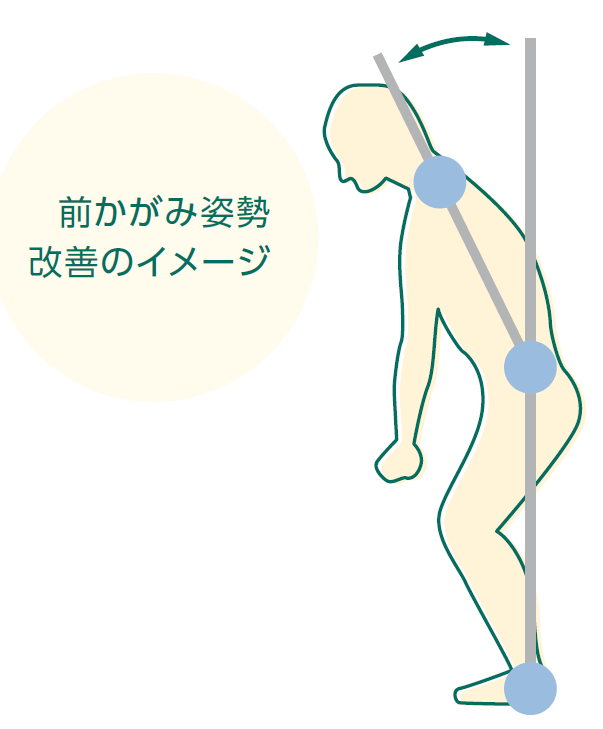 パーキンソン病患者の前かがみ姿勢に対する治療法 当院の取り組み 金沢脳神経外科病院